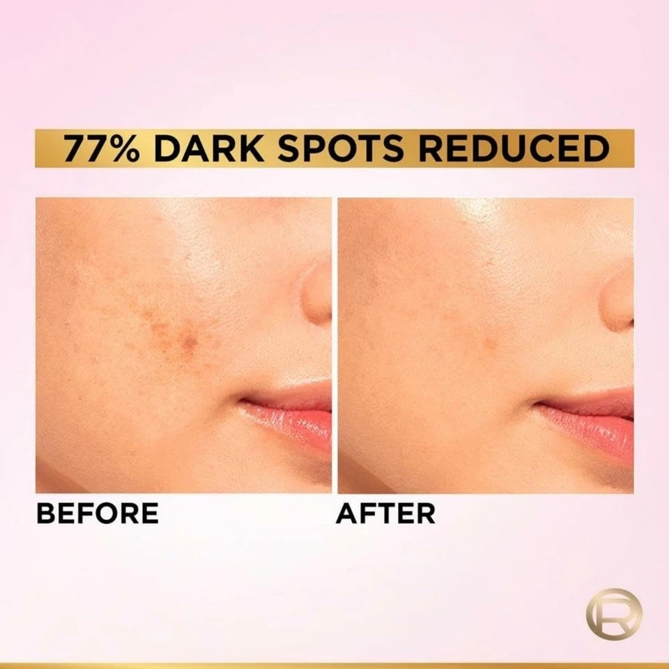 L’Oreal Paris Glycolic Bright 8% Face Serum for Brightening Dark Spots 30ml