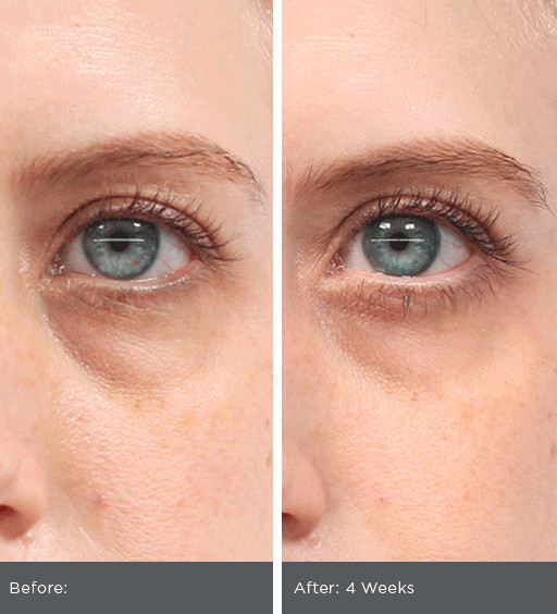 Triple-Peptide EYE SERUM w/ Hyaluronic Acid, Vitamin C – Bags-Dark Circles Cream