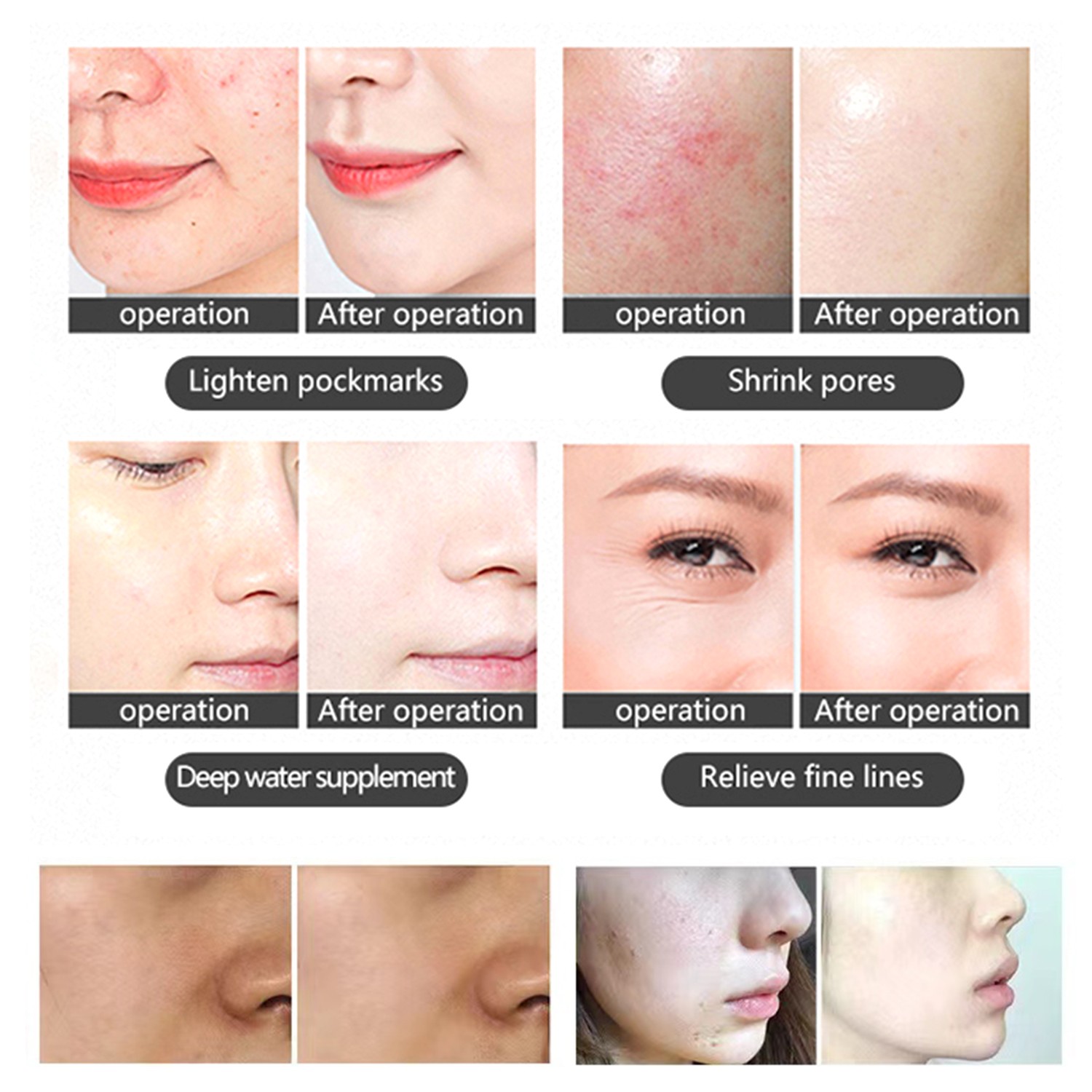 Professional 7 Colors LED Photon Photodynamic Light Therapy PDT Beauty Machine