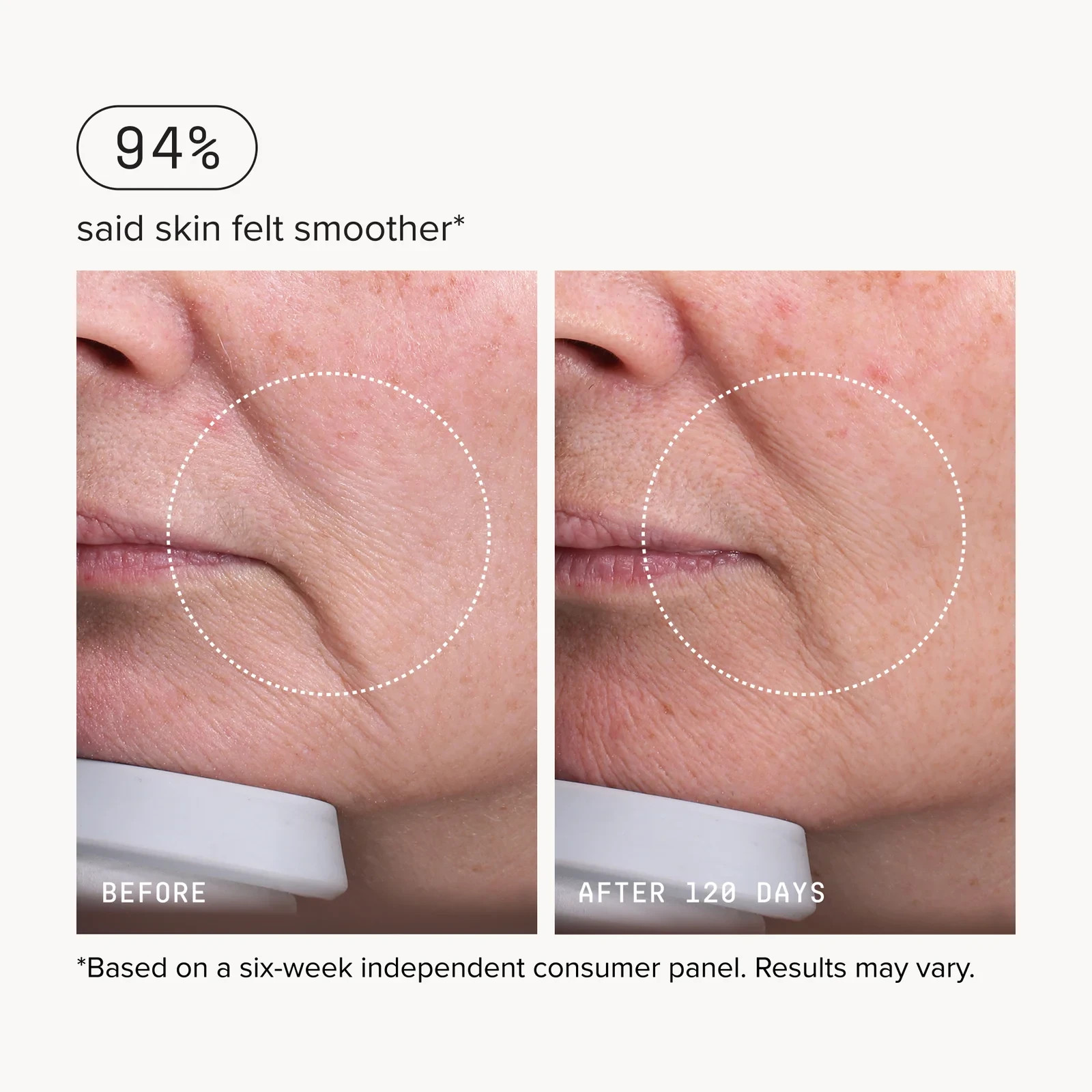 (2 pack) Needle-less® Serum