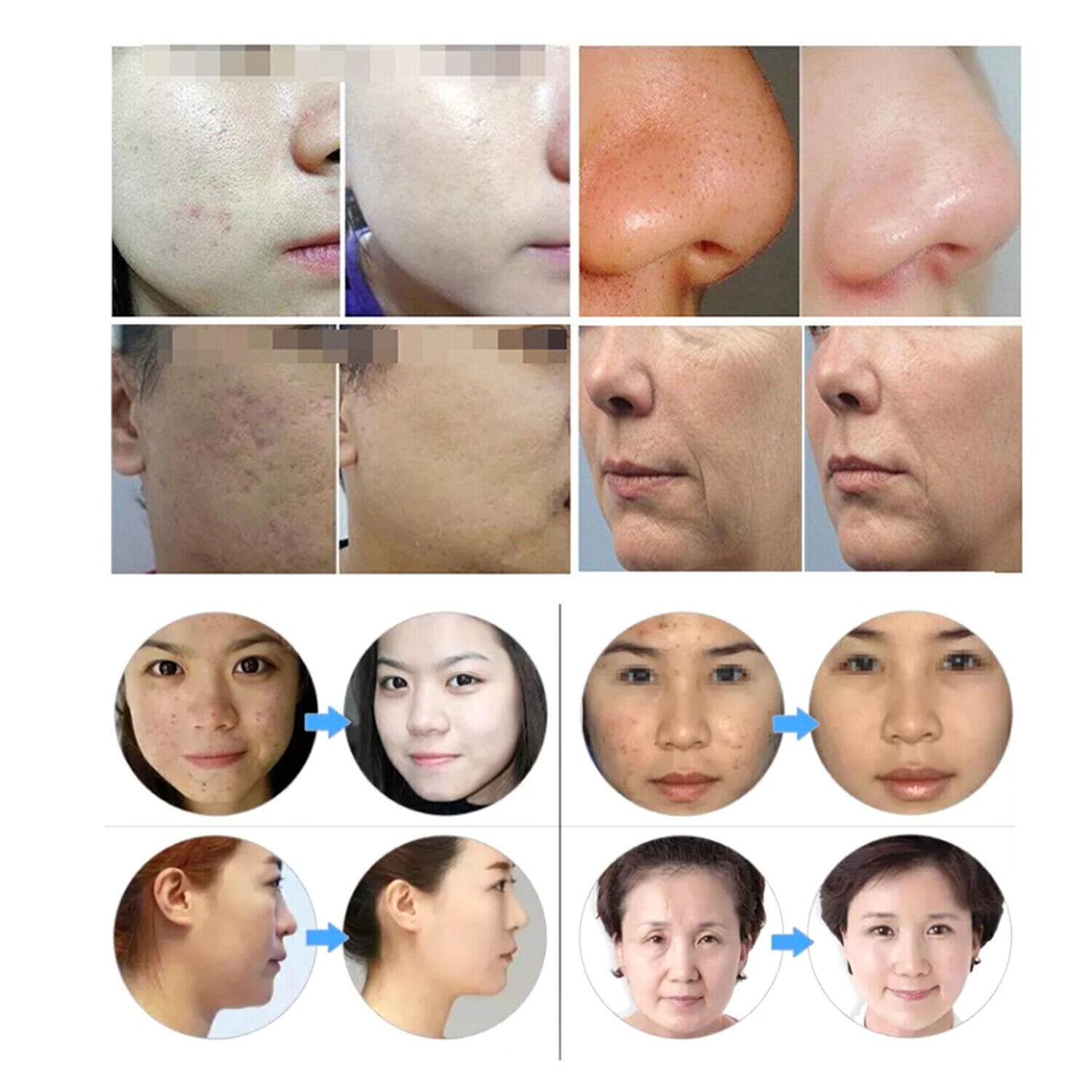 2 Handles RF Eye Face Body Wrinkle Lift Machine Anti aging Facial Skin Lifting