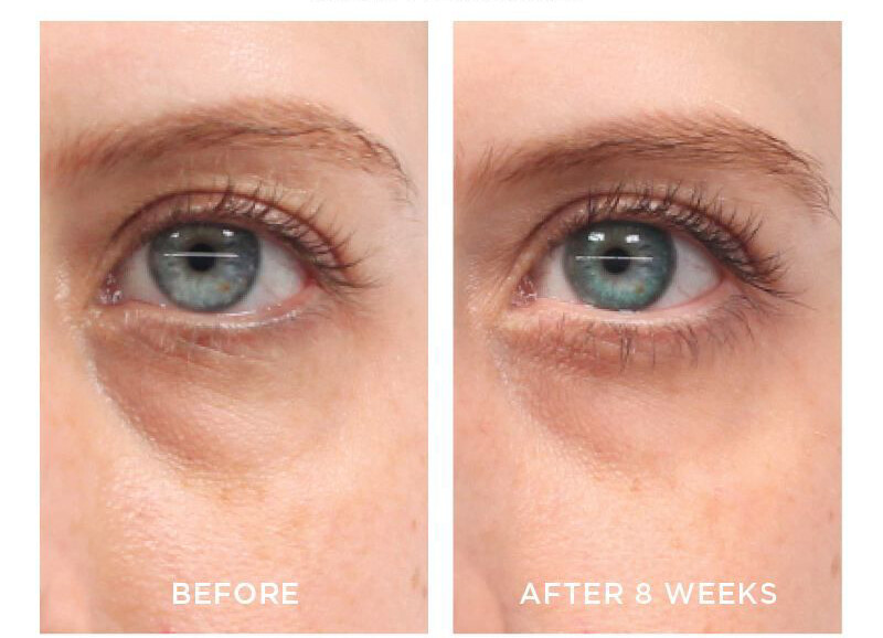 Anti-Aging Retinol Vitamin A 2.5% TURN BACK THE CLOCK Facial Face Serum Cream