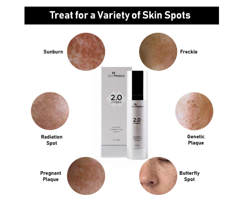 SkinMedica Lytera 2.0 Pigment Correcting Facial Serum – 2 Oz/60ml USA