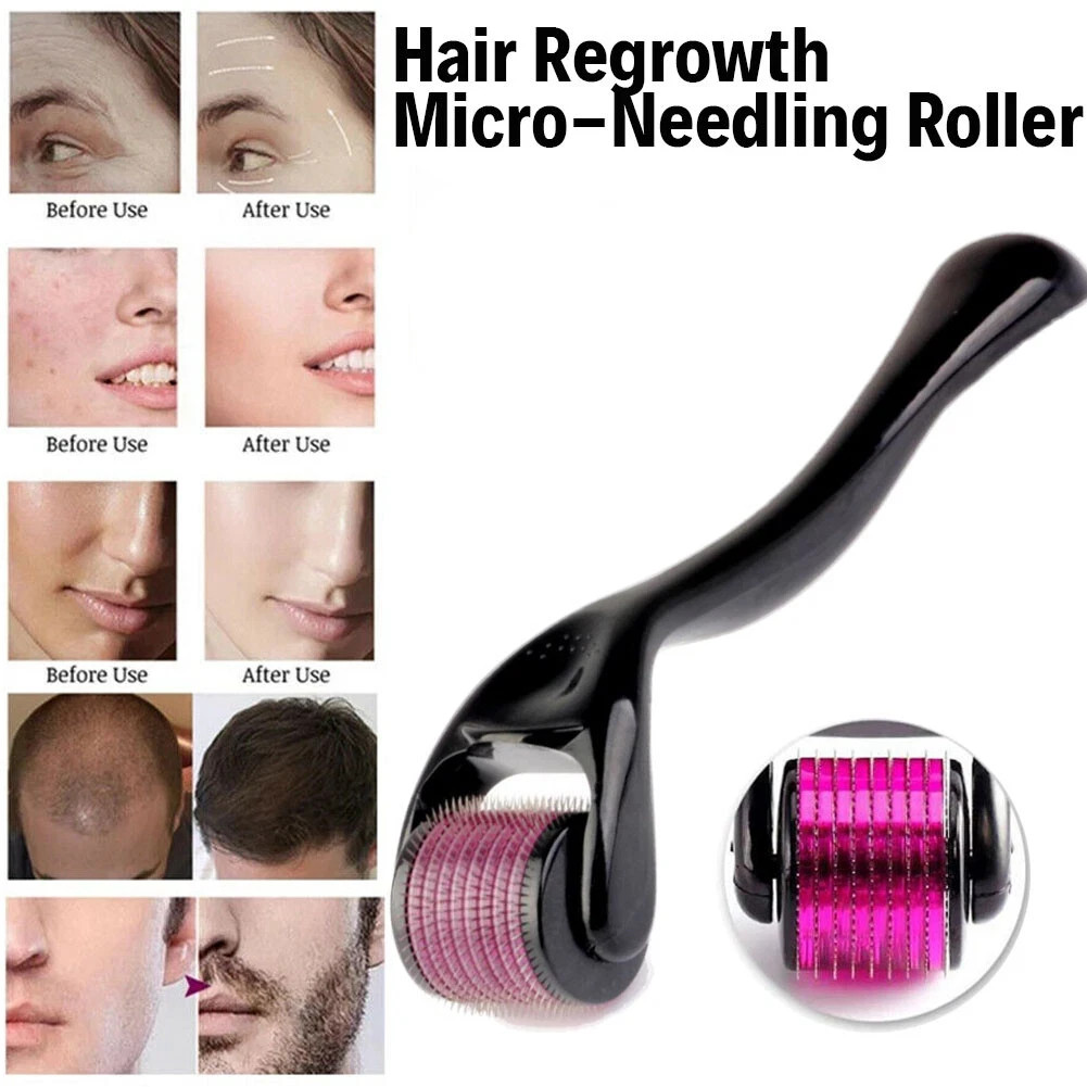 Beard Derma Roller For Hair Loss Beard Growth 0.50MM Titanium Derma Roller micro