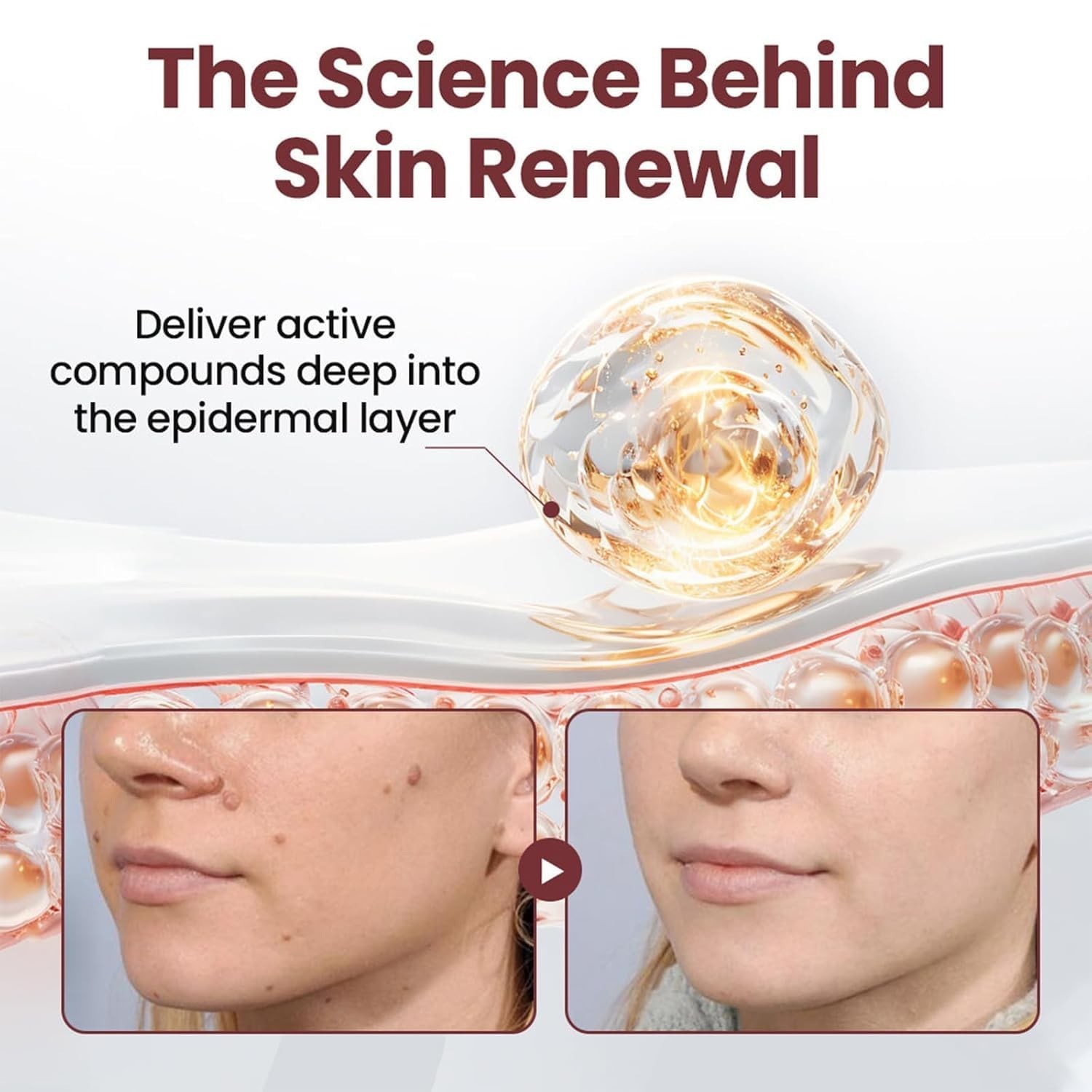 Daily Use Hydrating Renewal Cream with Black Rice – Gel for Smoother Skin