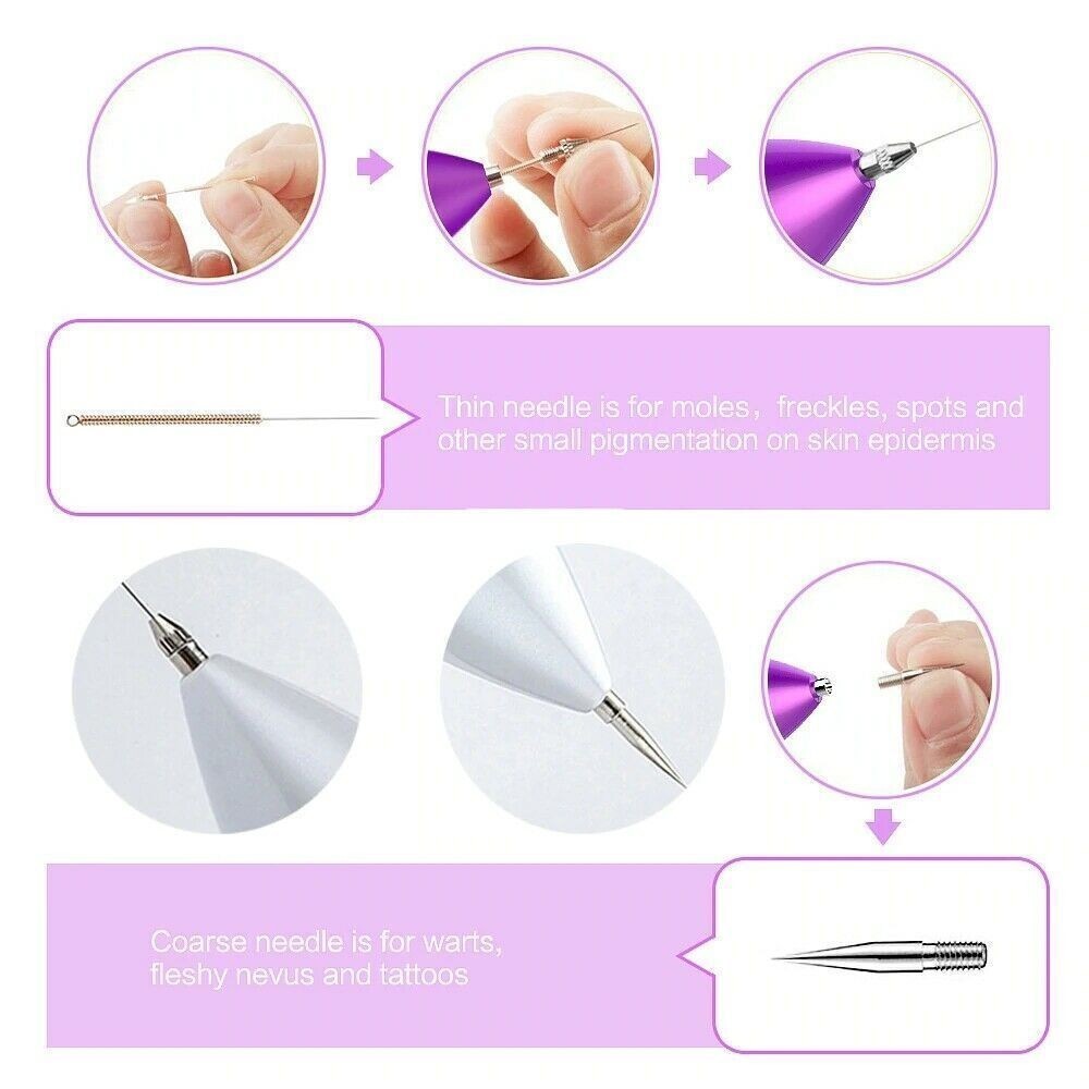 Electric Laser Plasma Pen Mole Removal Dark Spot Remover Skin Wart Tag Tattoo US