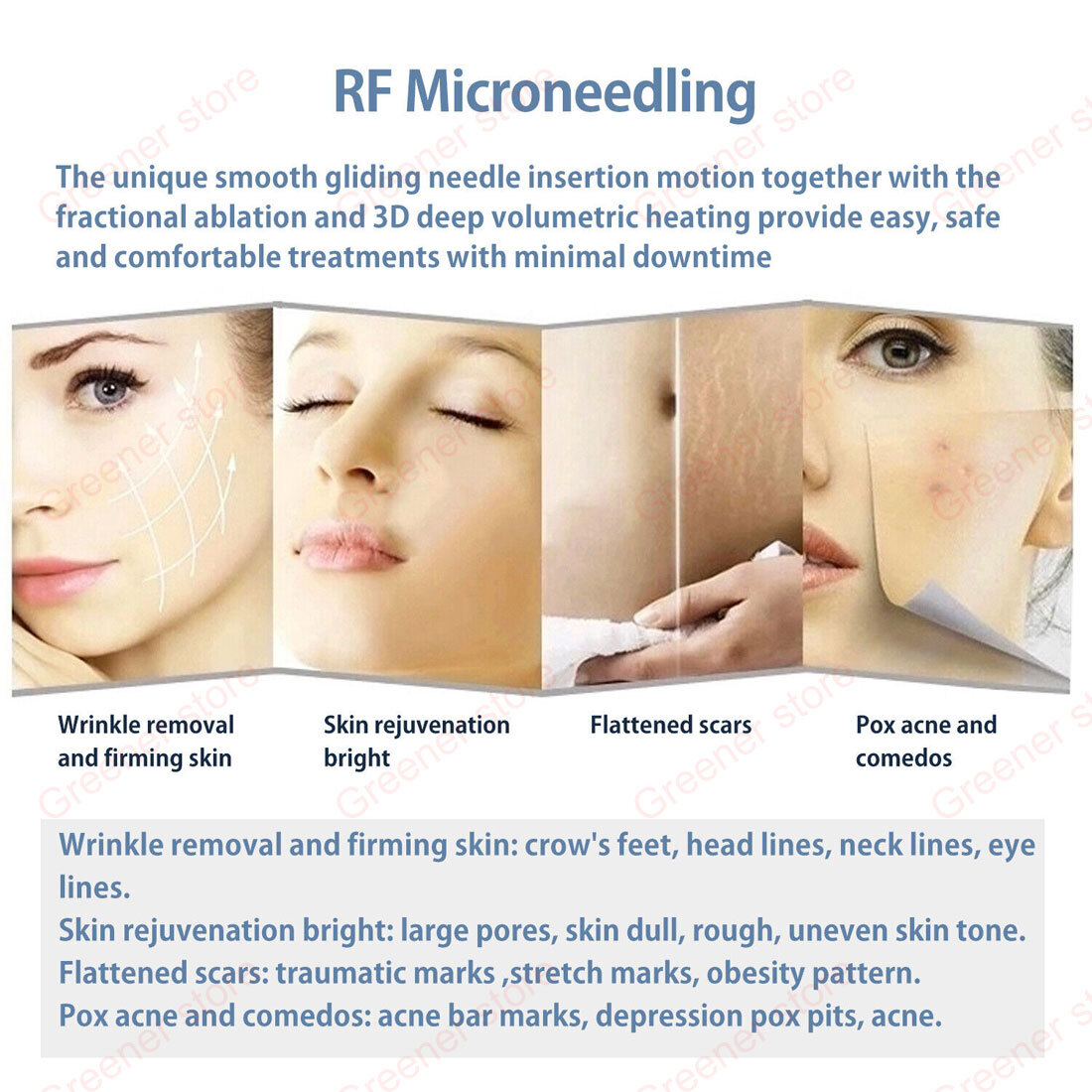 2in1 Fractional RF Machine 10/25/64/nano Cartridge Wrinkle Acne Scar Removal