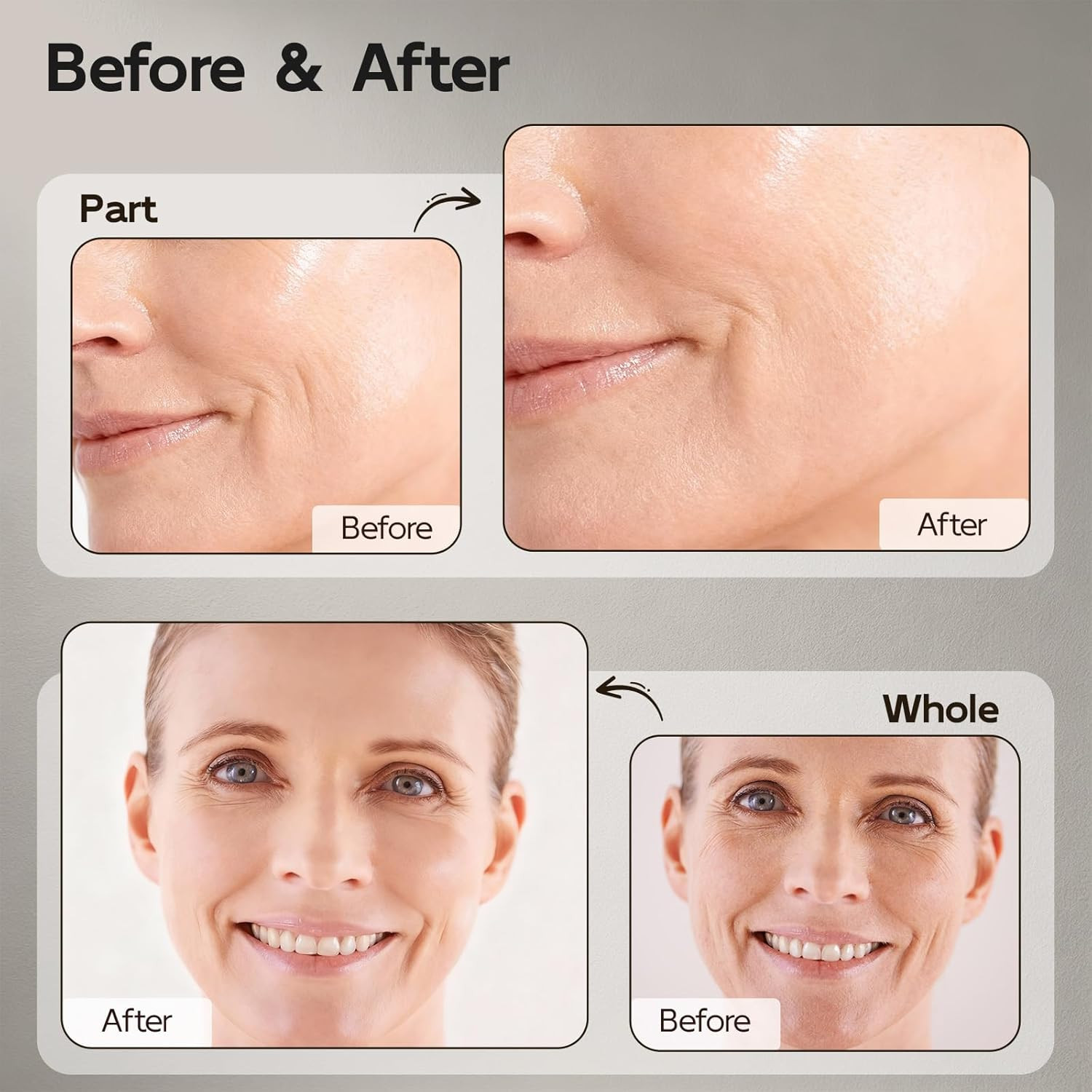 Retinol Serum for Face, anti Aging & anti Wrinkle B5 Resurfacing Retinol Serum w