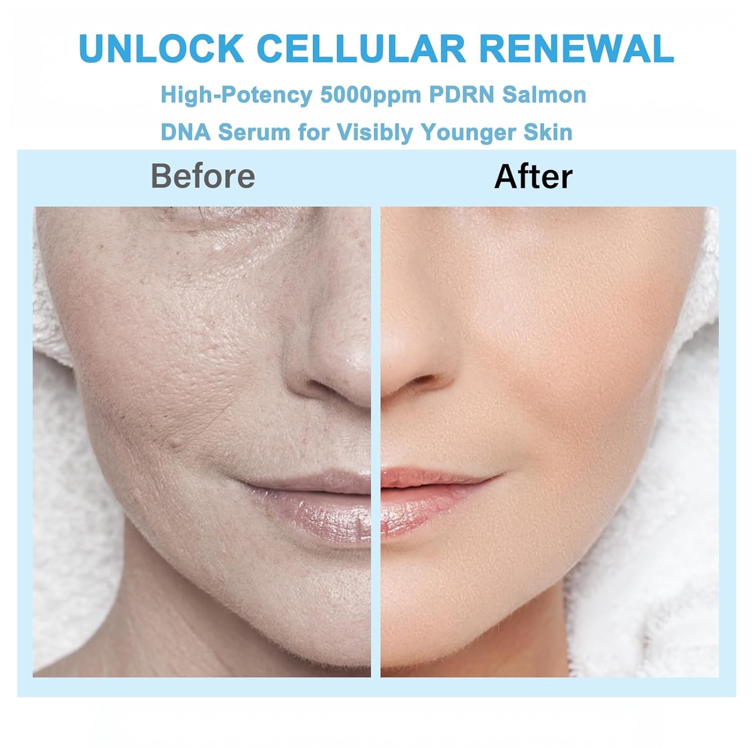 PDRN Salmon DNA Serum, Anti-Aging & Hydration, Collagen, Glutathione, 30 Vials