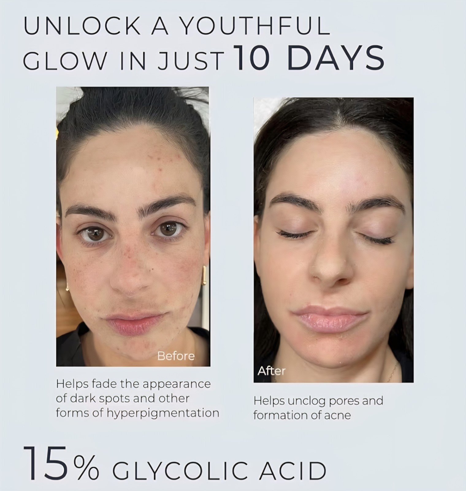InstaSkincare 15% Glycolic Acid Serum~ 2PK.2oz~AHA Exfoliating w Lactic Acid