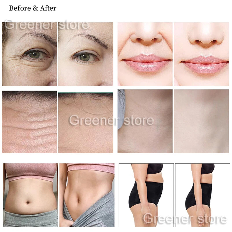 Pro 7D Facial Beauty Machine Fresh & Youth Body Massage Equipment