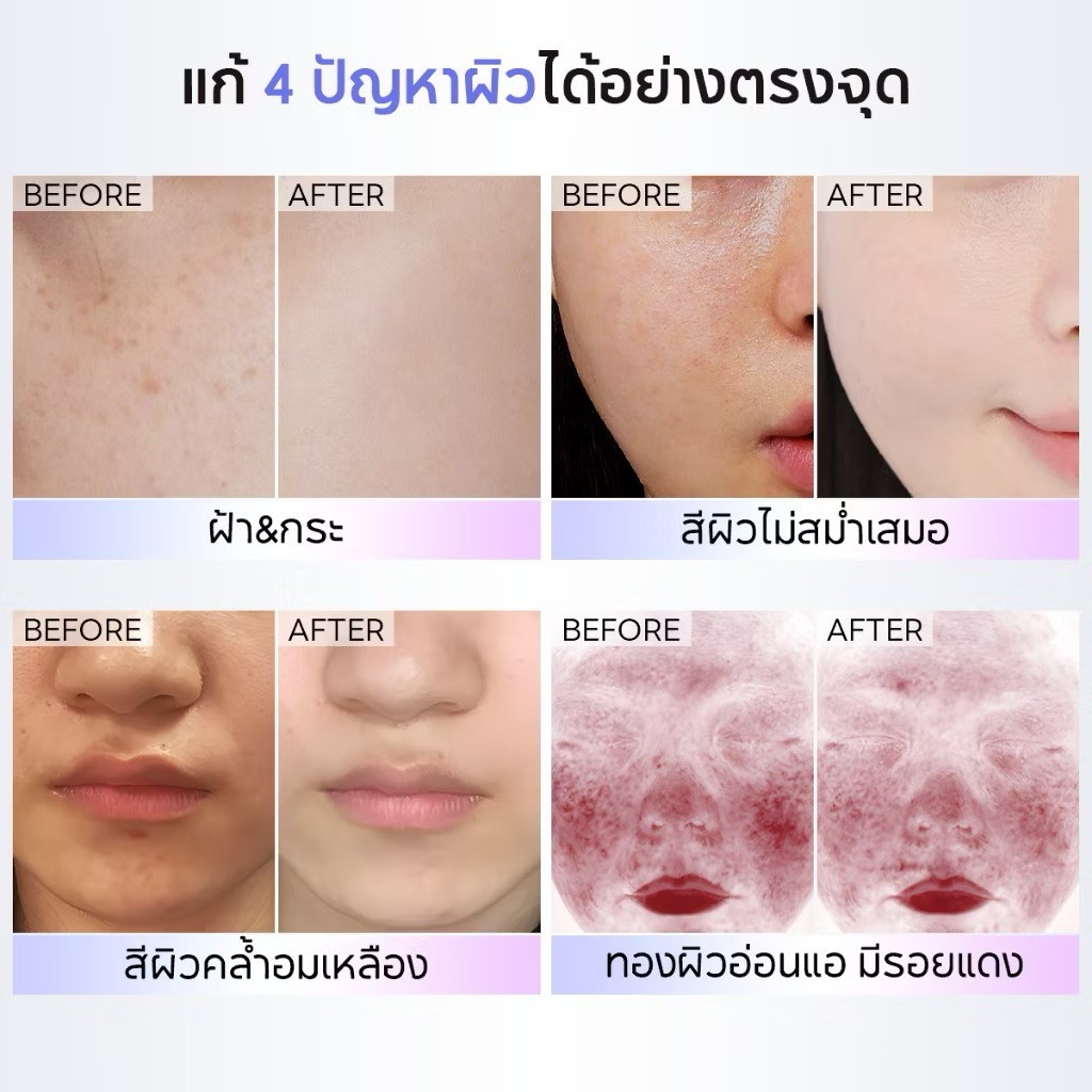PAPA FEEL SYMWHITE 577 Cream+ 577 Serum Anti-aging Moisturizing