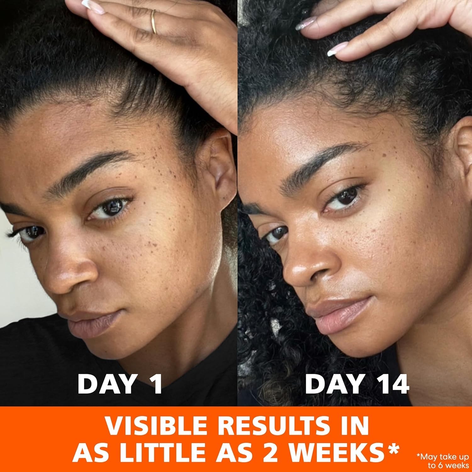 Palmer’s Skin Success Anti-Dark Spot Fade Cream with Vitamin E and Niacinamide,