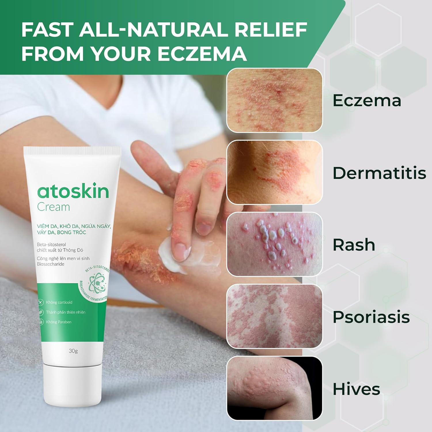 2x ATOSKIN Cream 30g Daily Moisturizer Shea Butter & Aloe Vera for Drynes Care