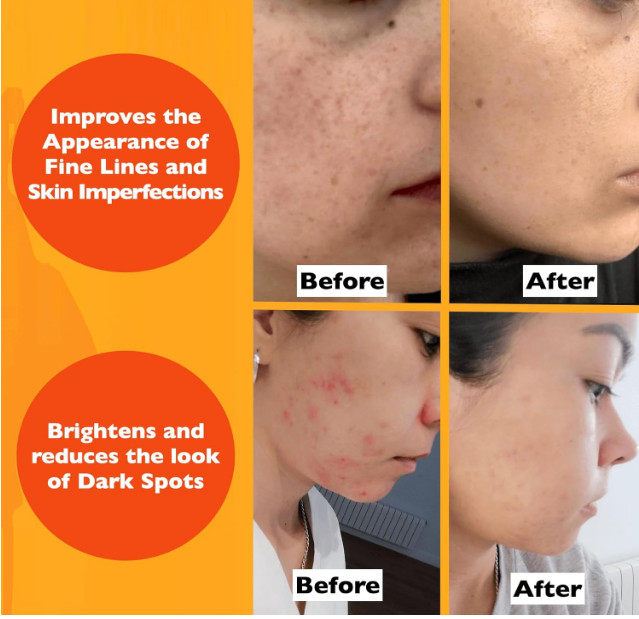 Vitamin C Serum For Face – Anti Aging Face Serum with Vitamin C, Hyaluronic Acid