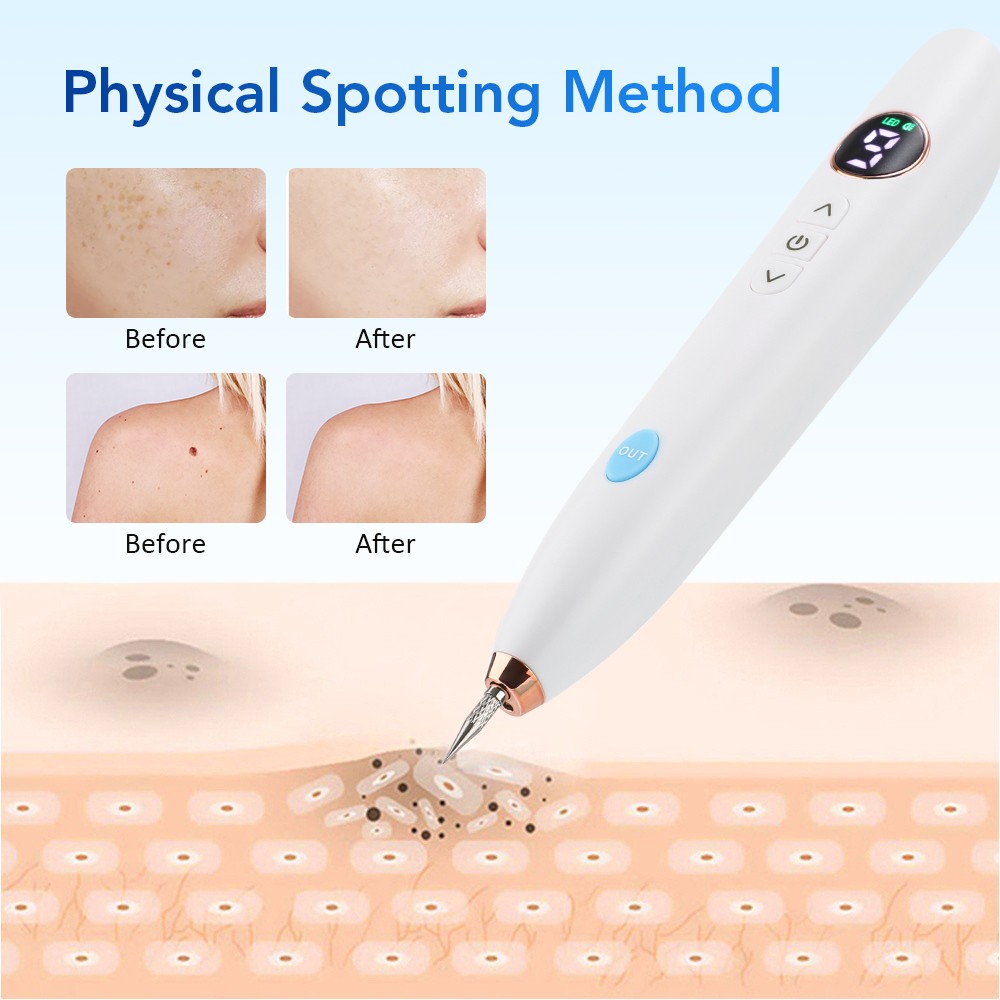 9 level Laser Plasma Pen Mole Removal Dark Spot Skin Tag Tattoo Wart Remover Pen