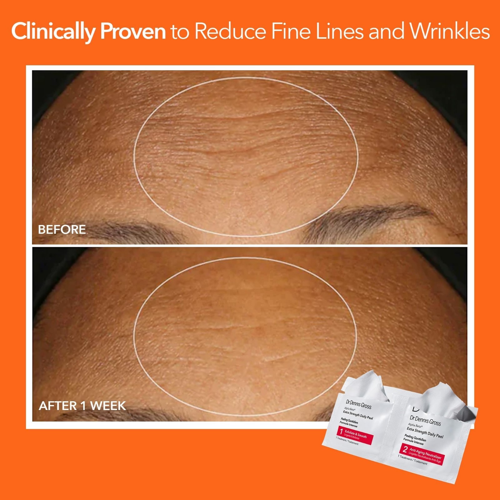 Extra Strength Daily Peel Pads – 2-Step Exfoliating Treatment for Anti-Aging, Sm