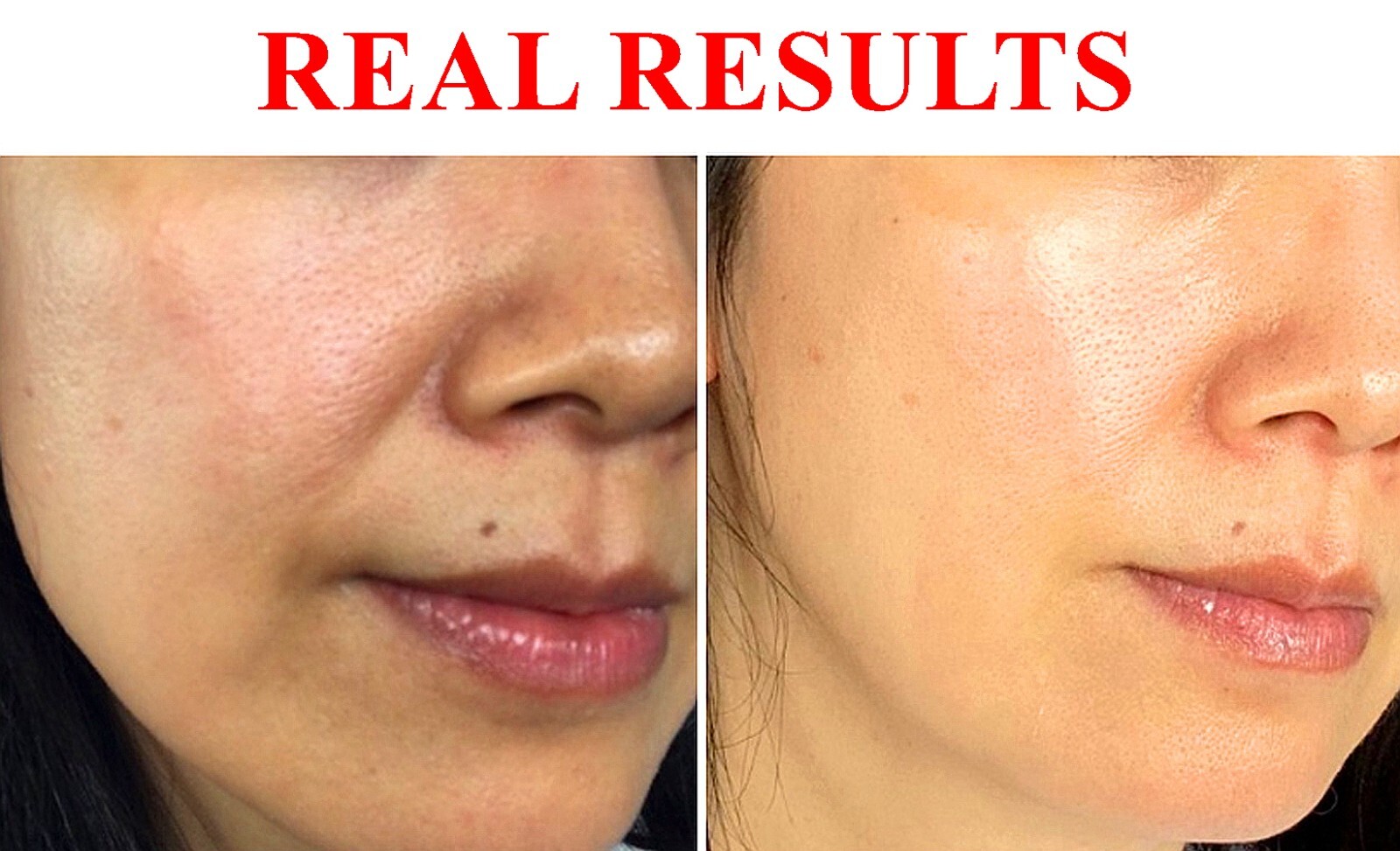 Ultimate Rejuvenation ─PDRN(20%) + Copper Peptide(8%) Glutathione Ampoule (5ml)