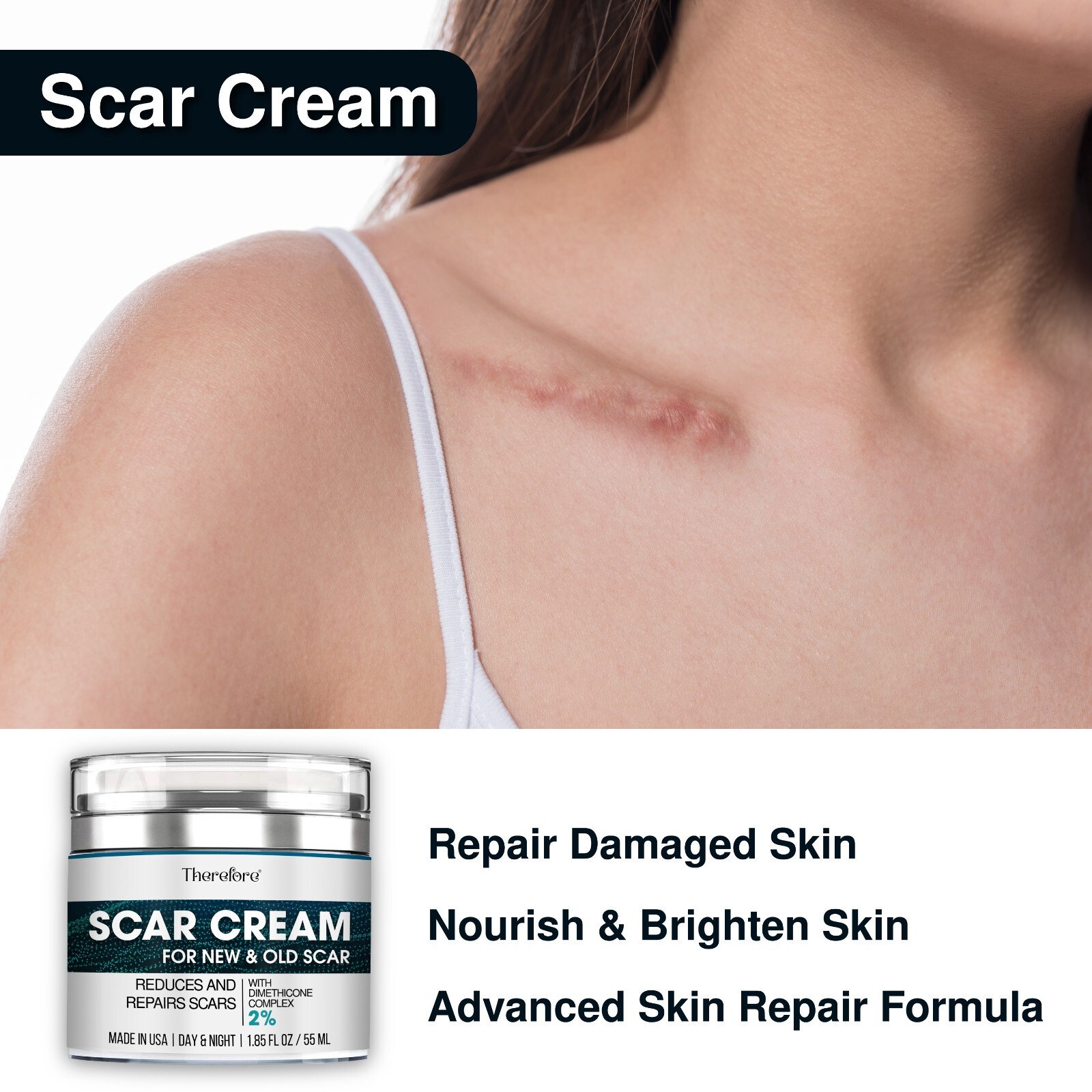 Advanced Scar Cream for Face and Body – Old & New Scar Removal Treatment 1.86 oz