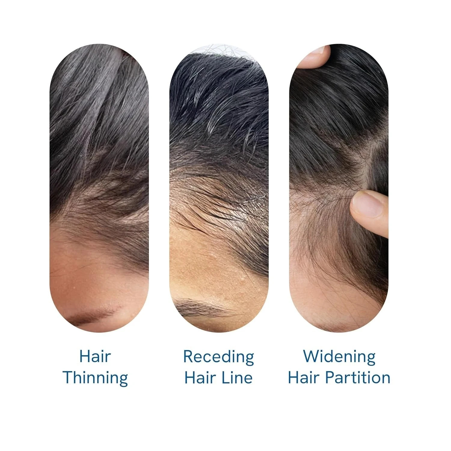 Be Bodywise Hair Growth Roll-On with 3% Rosemary 2% Aminexil & 3% Redensyl, 25ml