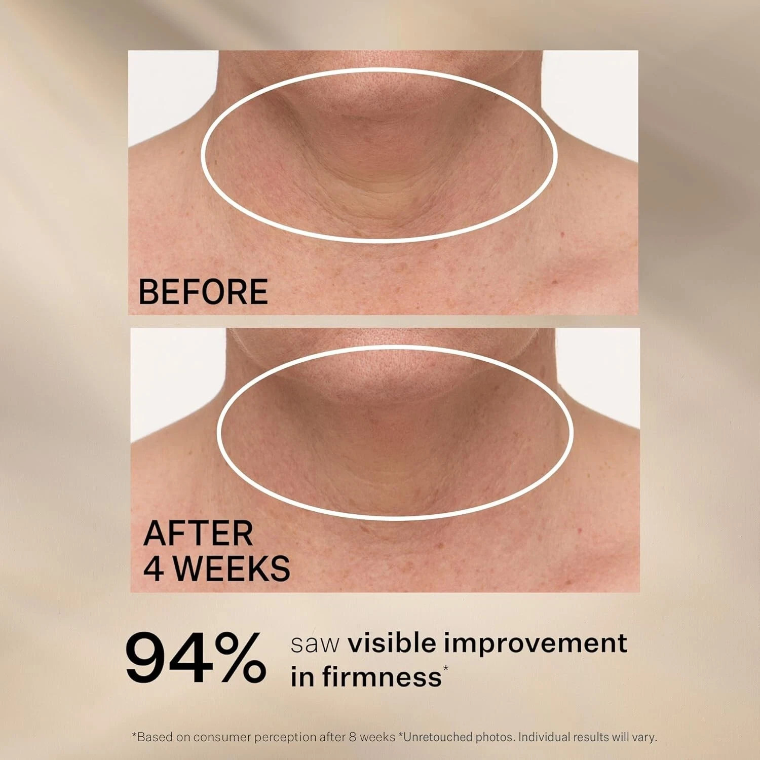 Open Box – StriVectin Tighten & Lift Advanced Neck Cream PLUS, 3.4oz