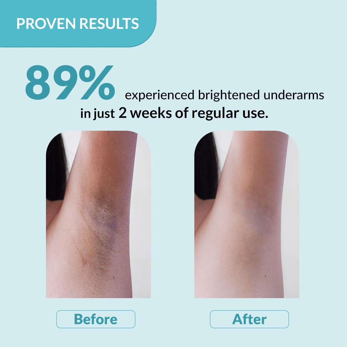 Fixderma Nigrifix Underarm Roll on (60ml) Exfoliates Underarm UNSEX