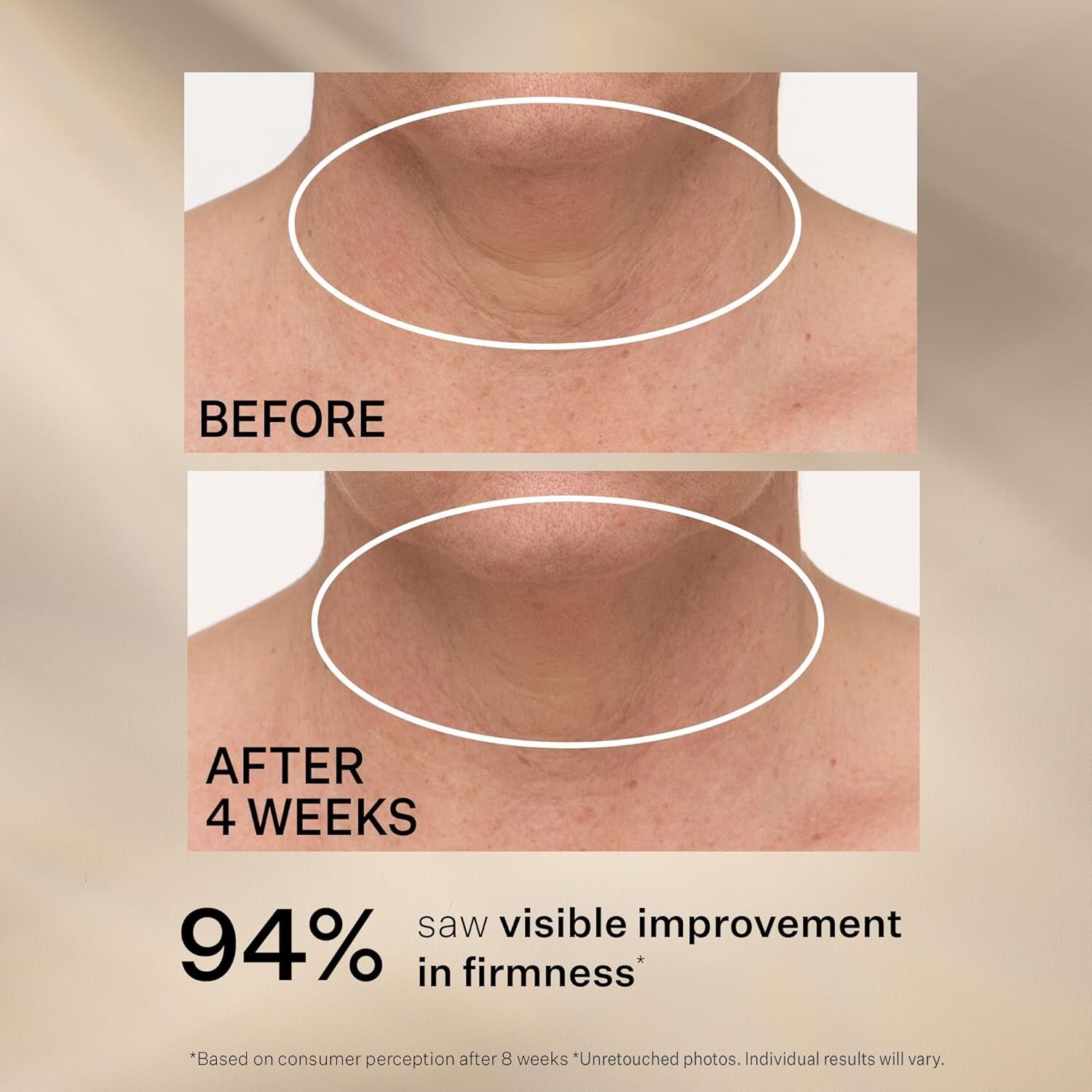 NEW W/O box – TL advanced Neck Tightening Cream Plus with NIA114 – 1oz
