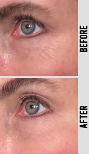 Peptide Collagen Serum AntiAging Wrinkle Cream-Matrixyl 3000 Hyaluronic Acid