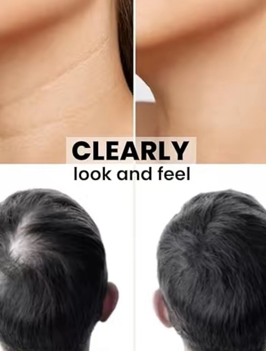 Hair Skin Beard Mustache Activator Beard & Hair Growth Derma Roller Micro Needle