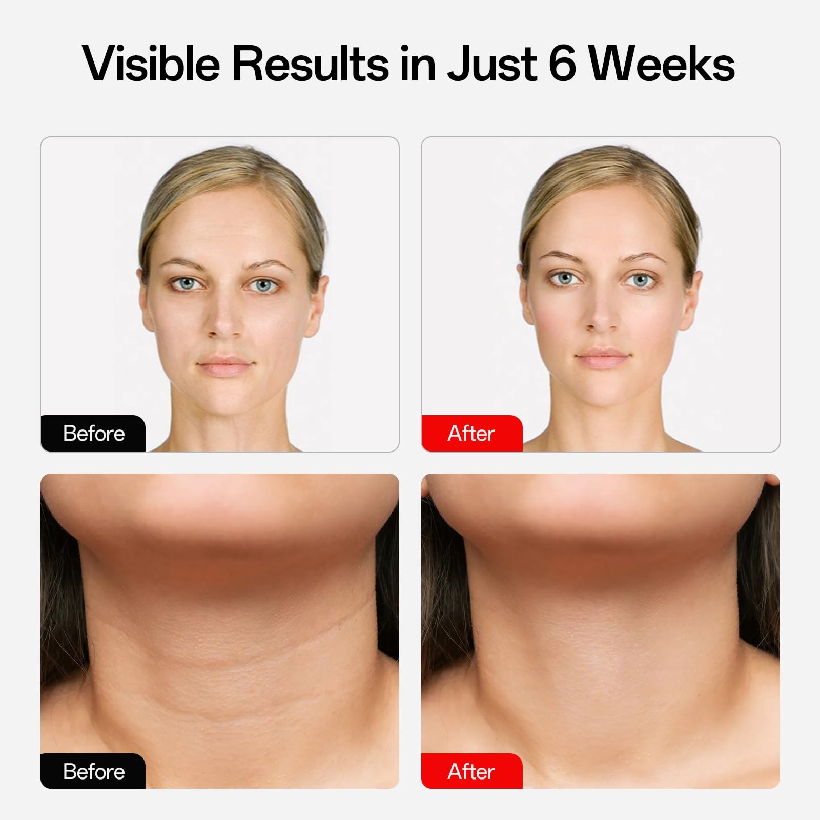 Facego Red Light Mask for Face and Neck, 7 Colors Red Light Face Mask with Re…