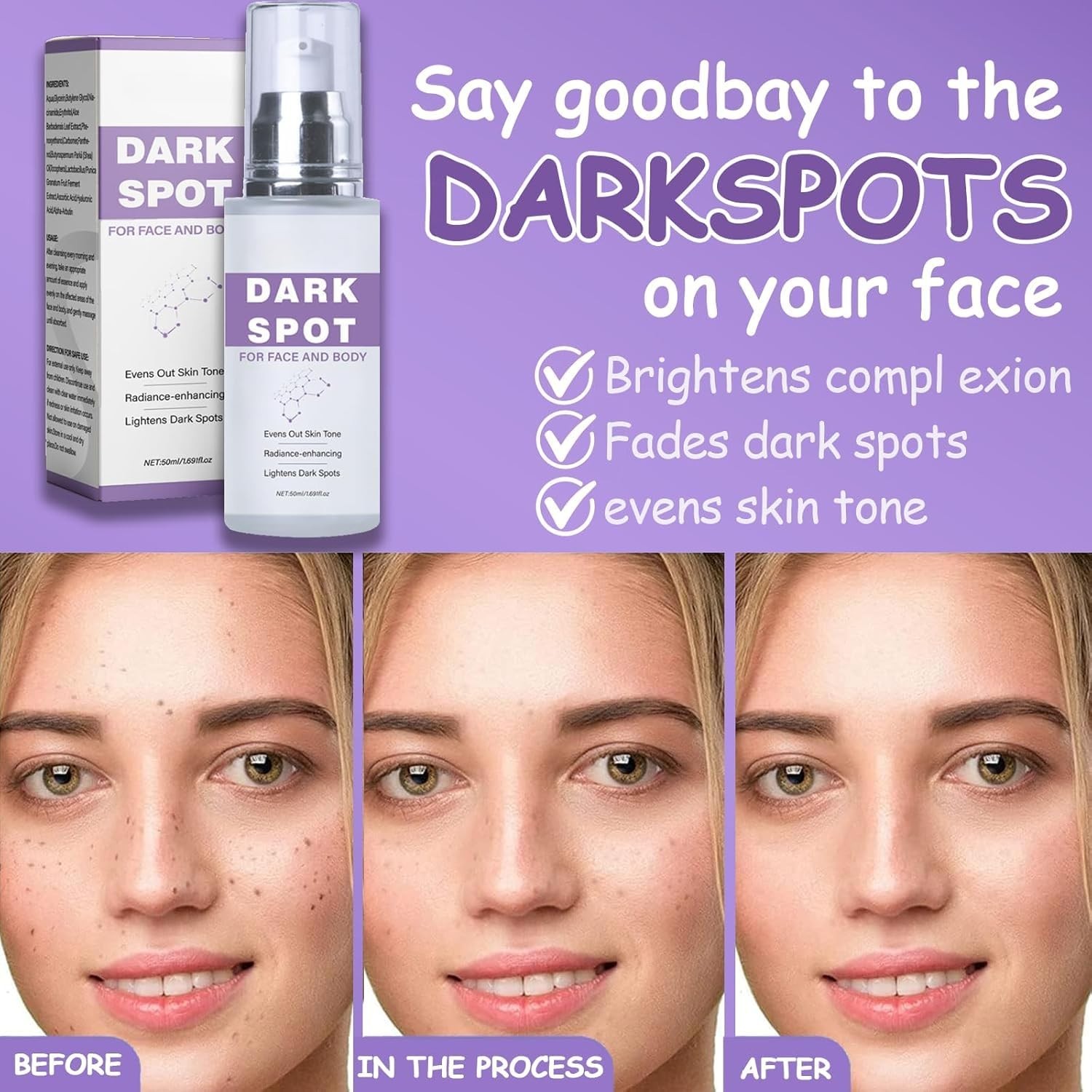 Effective Dark Spot Remover for Face & Body – Age Spots, Sun Spots, Freckles, Me