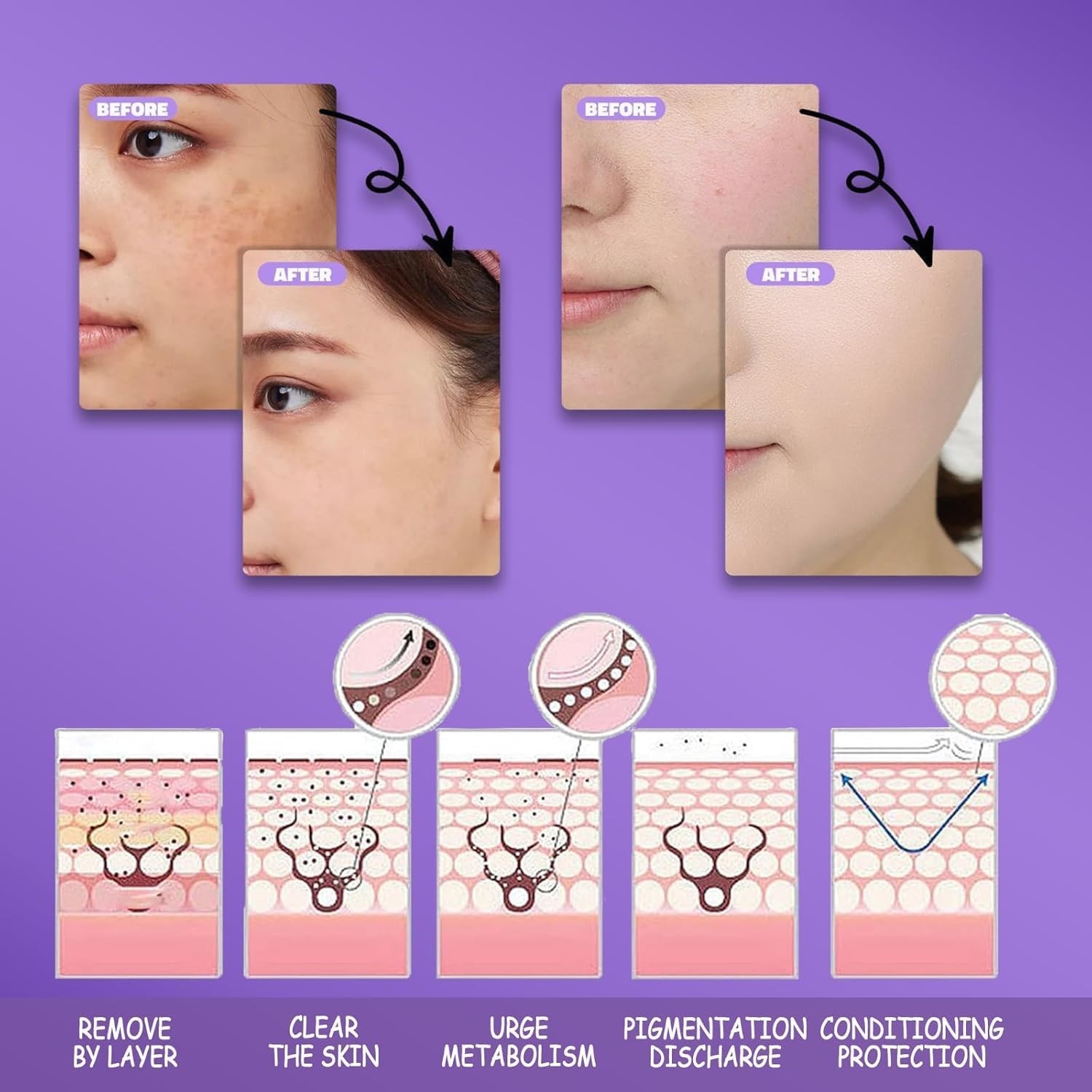 Effective Dark Spot Remover for Face & Body – Age Spots, Sun Spots, Freckles, Me
