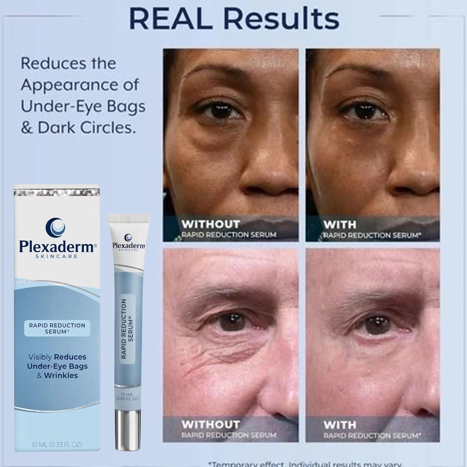 Plexaderm Rapid Reduction Eye Serum, Visibly Reduces Under-Eye Bags & Wrinkles