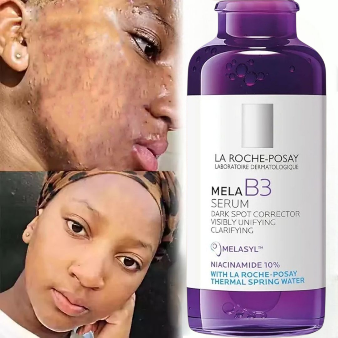La Roche-Posay 3 In 1 Mela B3 Set Serum SPF 30 Dark Spot Brightening [USA Stock]