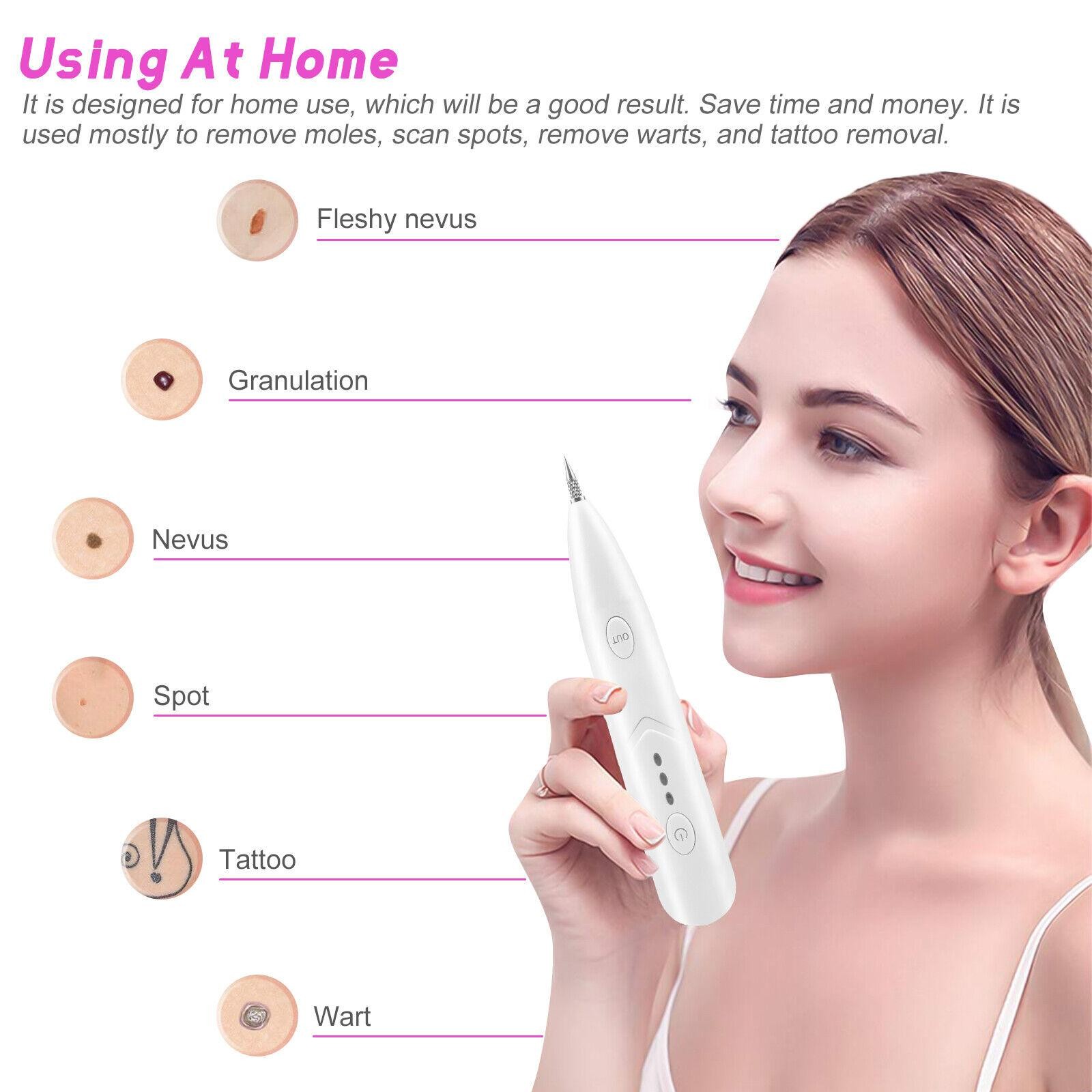 Adjustable Laser Pen Mole Removal Age Spot Remover Skin Wart Tattoo Tool