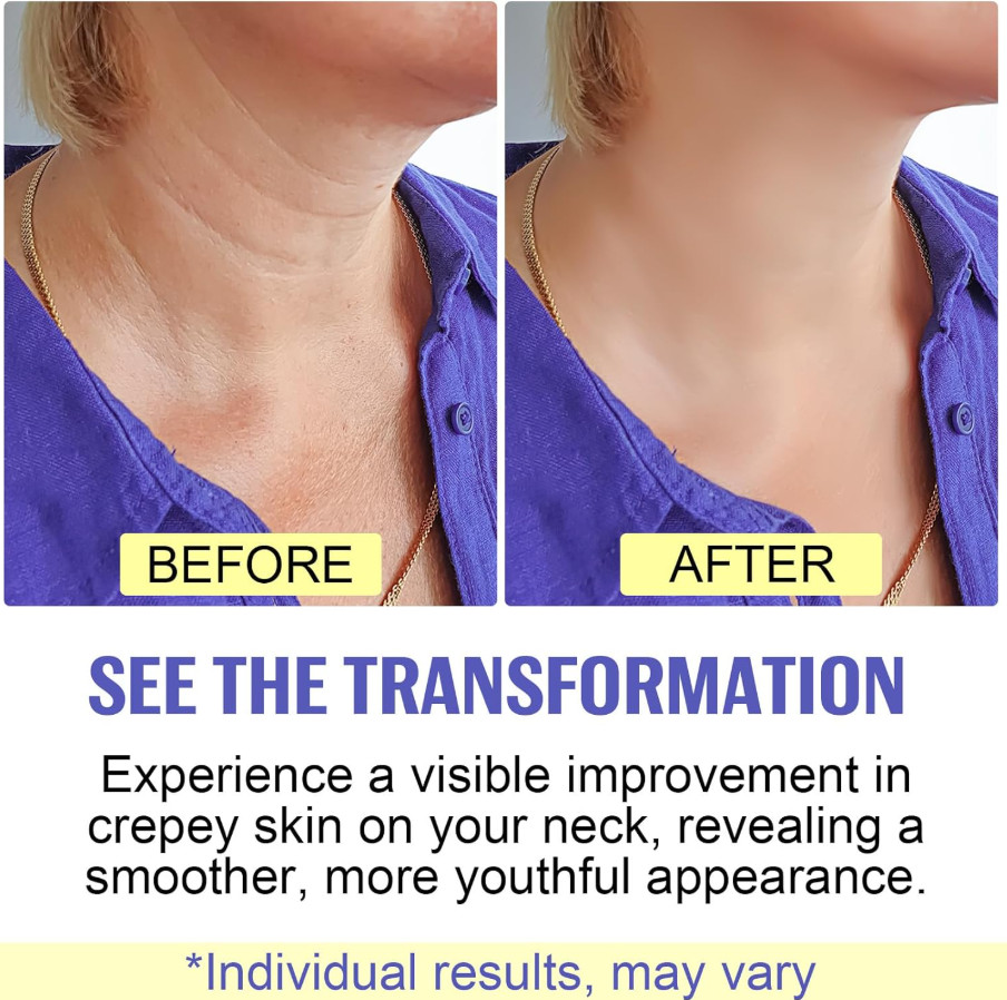 2024 New Pure Neck Firming Cream, Anti-Aging Tighten & Lift Neck Cream, Chest Ne