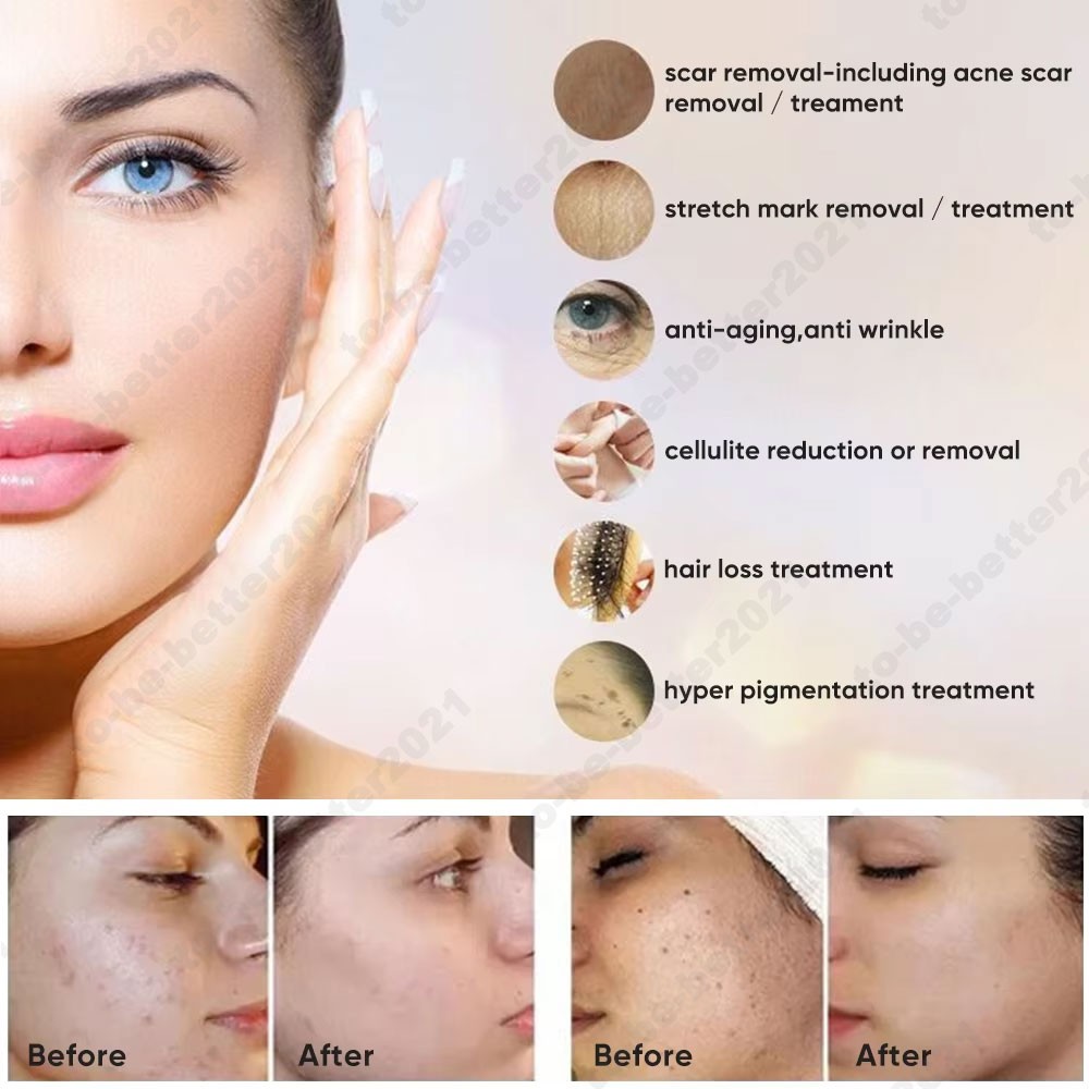 Professional Electric Wireless Microneedling Nano Pen with 10pcs Cartridges Kit