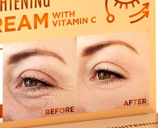 Quick Fix Vitamin C Instant Eye Tightener Under Eye Cream for Dark Circles 20 ml