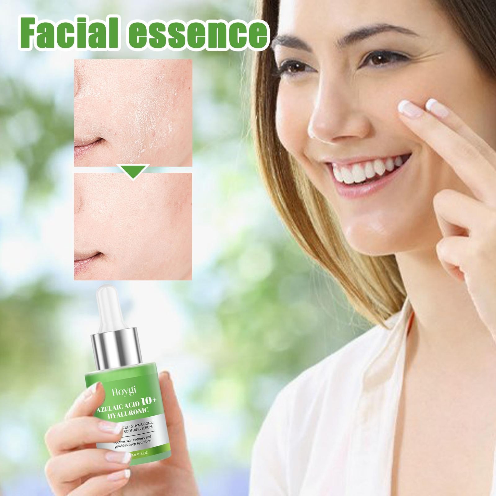 Azelaic Anua Acid Azelaic Acid 10 Hyaluron Redness Soothing Serum, 30ml/ 1.01 fl