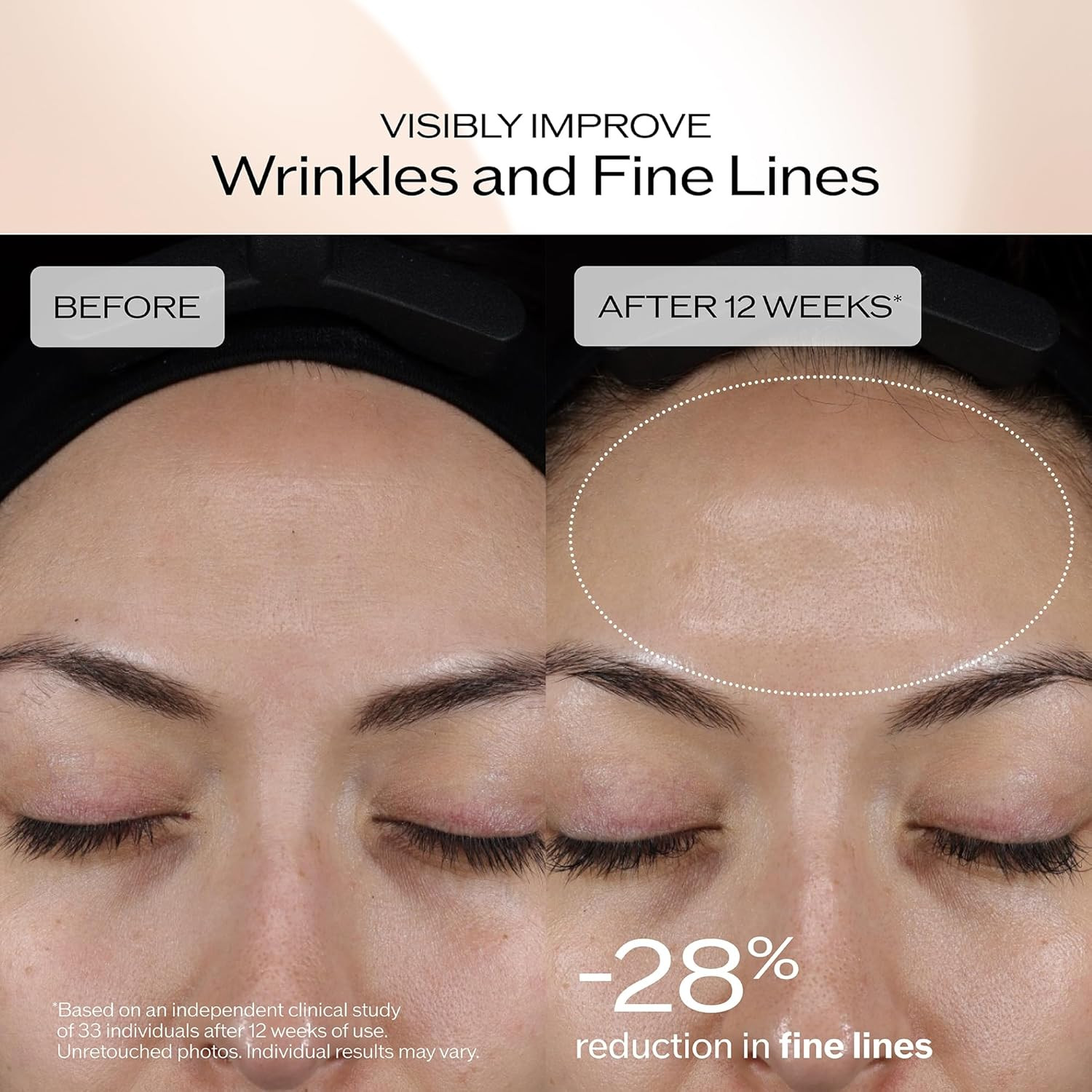 Shiseido Benefiance Dark Spot and Wrinkle Smoothing Face Serum – Visibly Improve