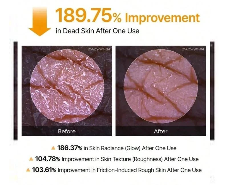 Dr.Melaxin Peel Shot Kojic Acid Turmeric Exfoliating Spray 200ml