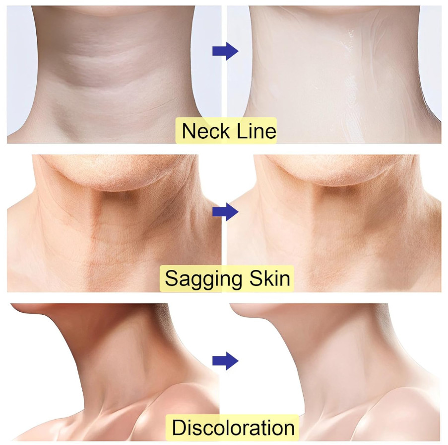 2024 New Pure Neck Firming Cream, Anti-Aging Tighten & Lift Neck Cream, Chest Ne