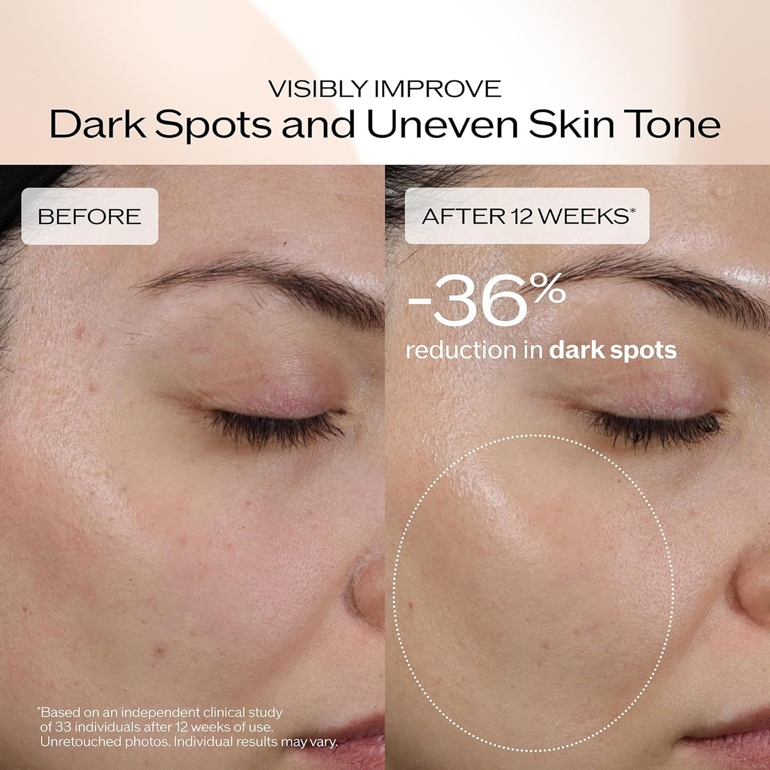 Shiseido Benefiance Dark Spot and Wrinkle Smoothing Face Serum – Visibly Improve