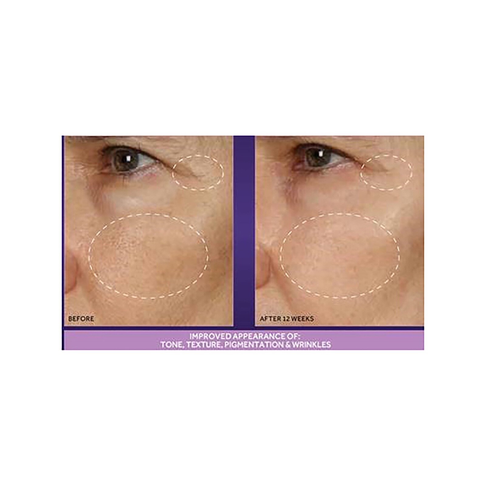 NO7 Advanced Retinol 1.5% Complex Night Concentrate, 1 fl oz.^