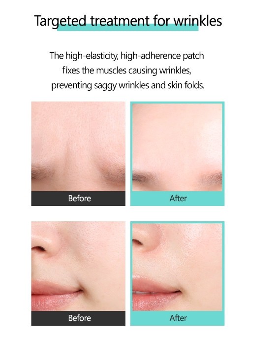RIRE Smile Wrinkle Patch x 100EA Korean Seller Korean Cosmetics Made in korea