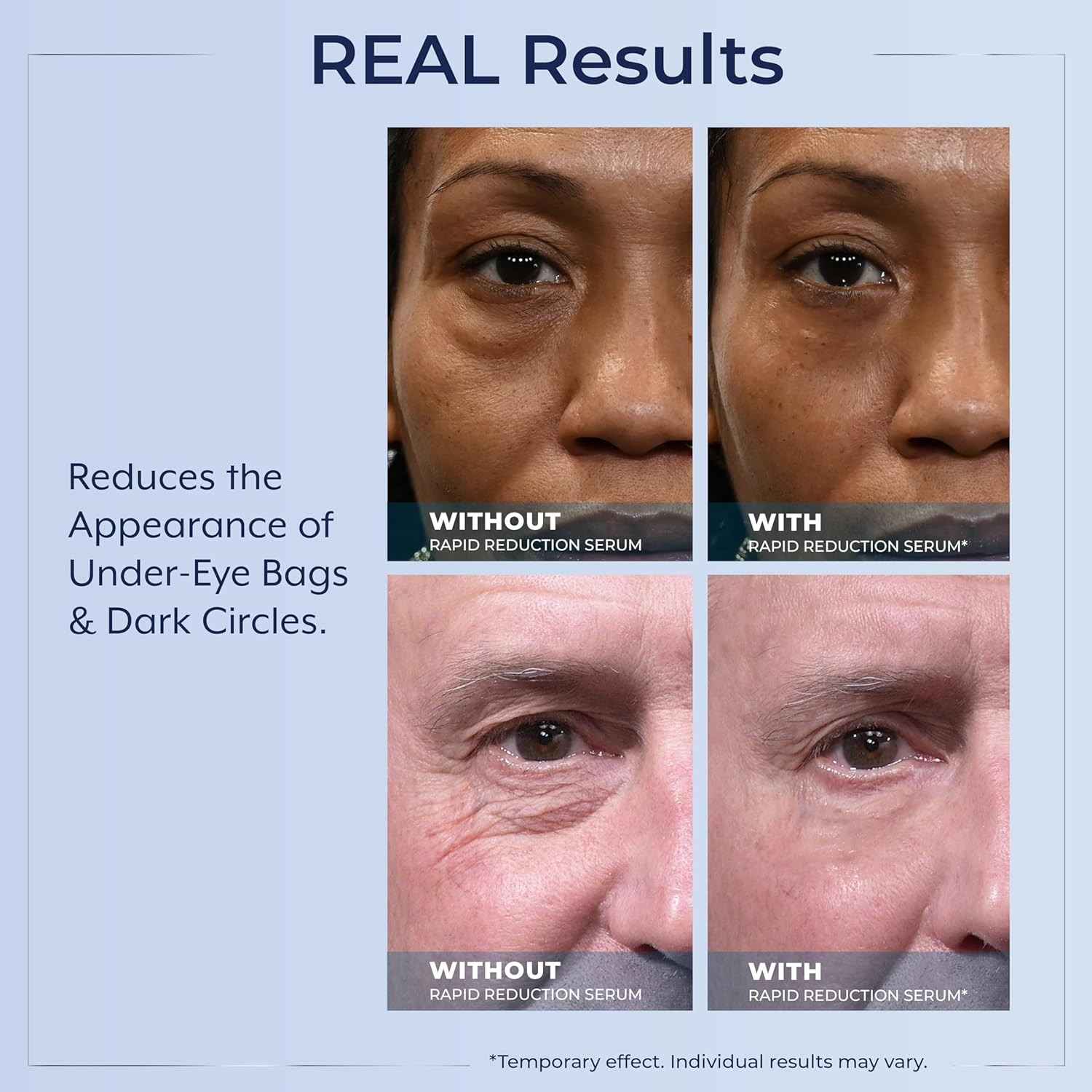 Rapid Reduction Plexaderm Eye Serum Reduces Under Eye Bags Dark Circles Wrinkles