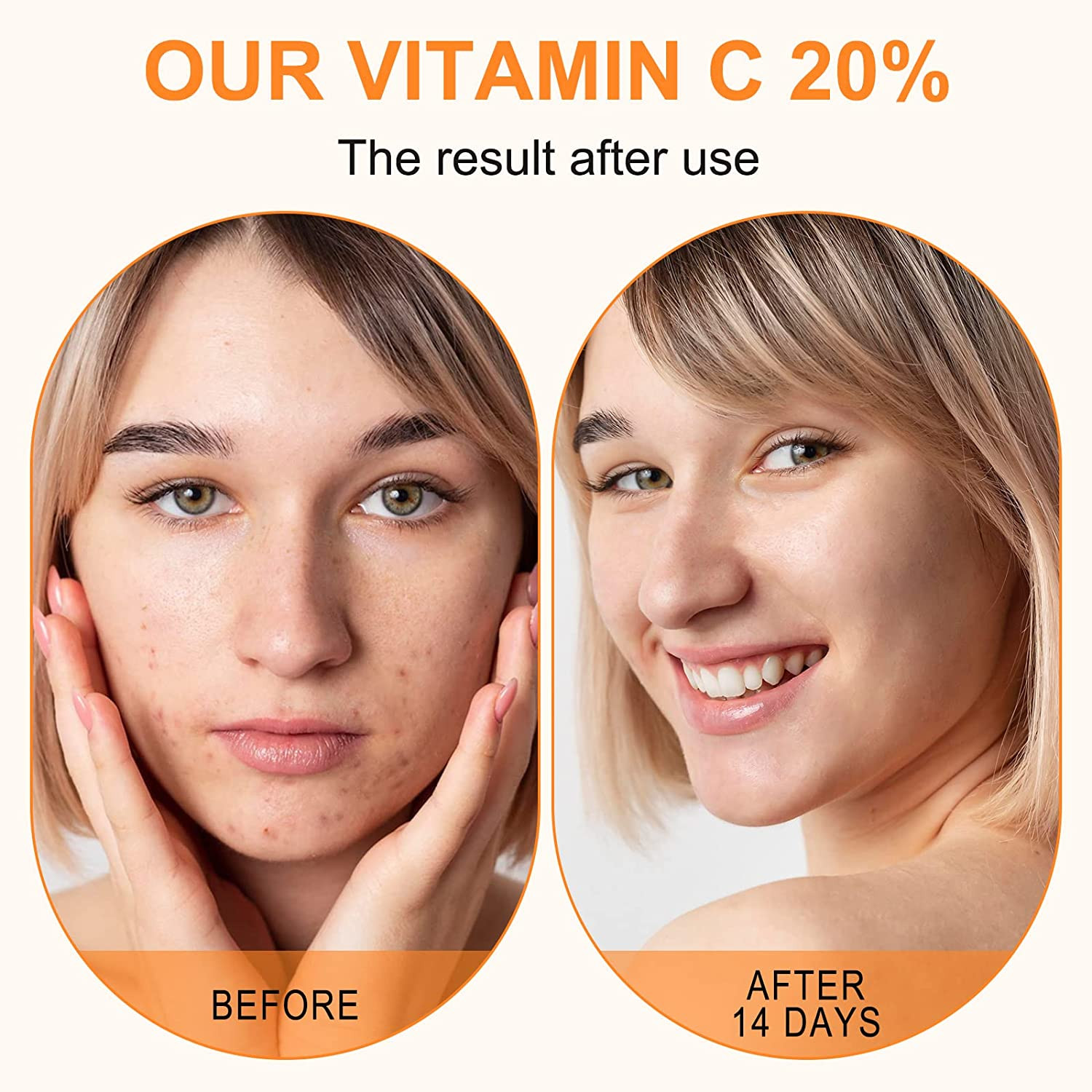Premium 20% Vitamin C Serum for Face with Hyaluronic Acid, Retinol & Amino Acids