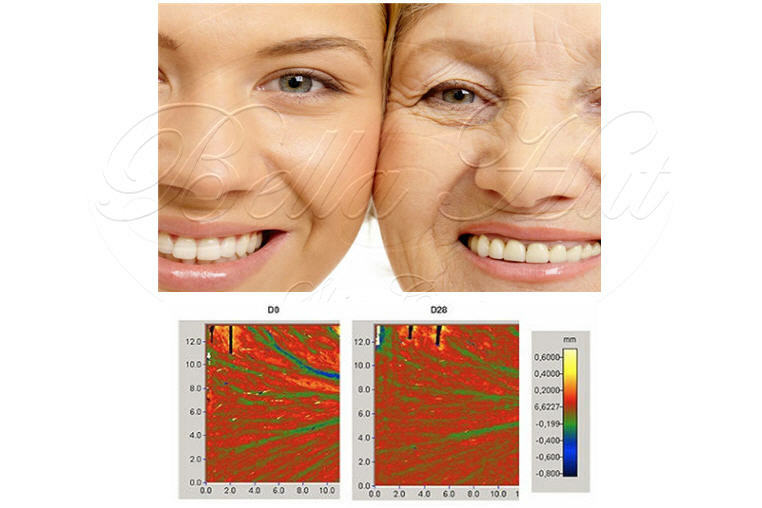 SYN®-AKE PEPTIDE REDUCE CROW’S FEET & FOREHEAD WRINKLES