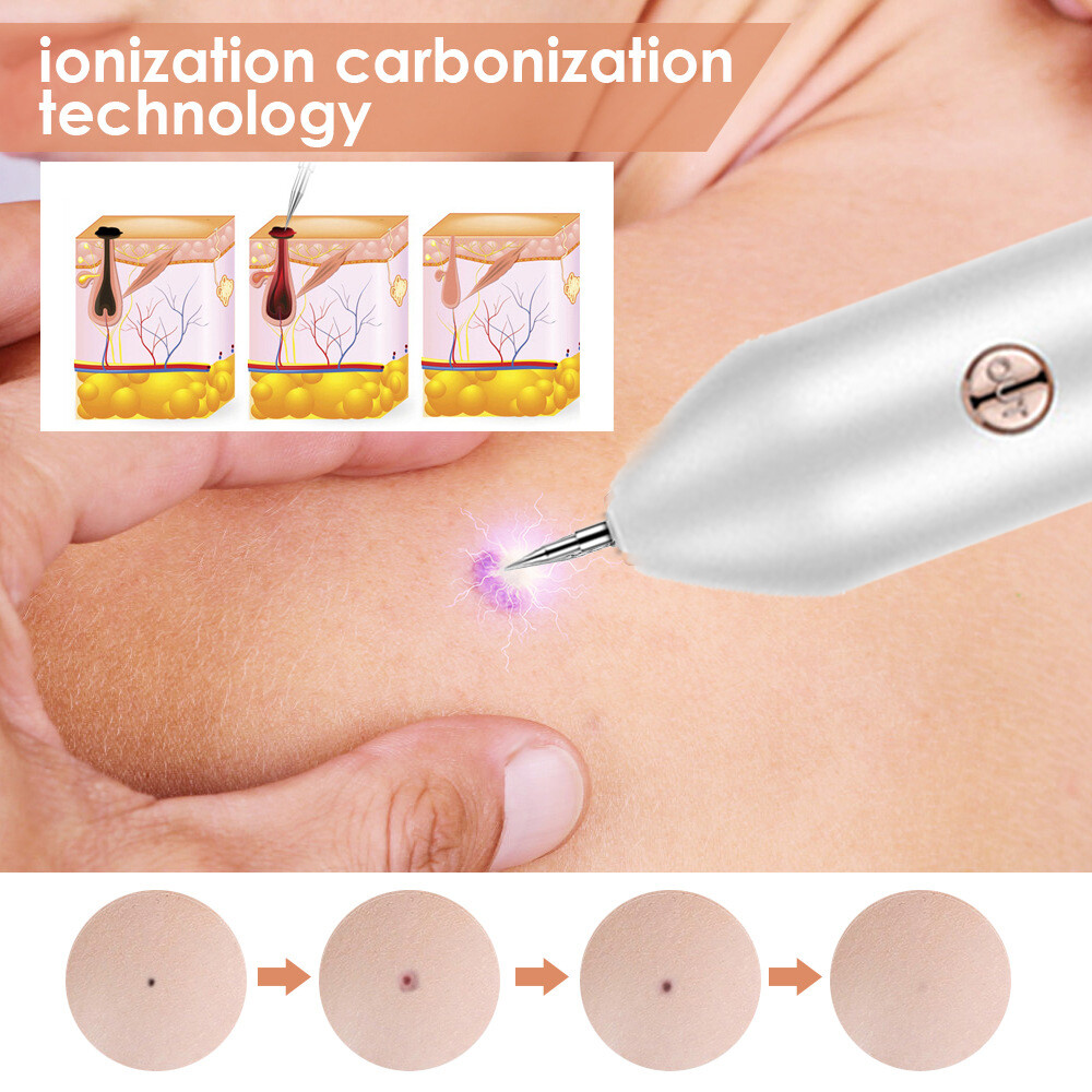 Laser Plasma Pen Mole Removal Dark Spot Skin Tag Tattoo Mole Wart Remover Pen