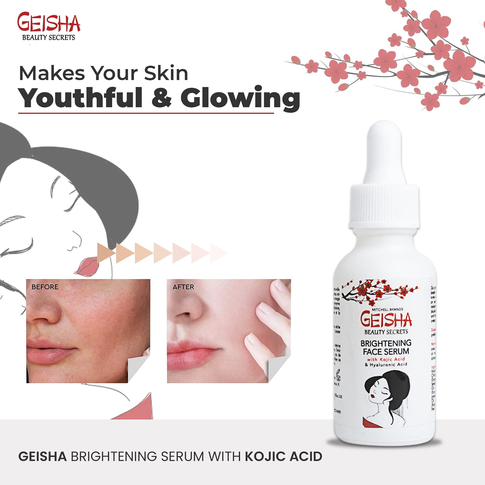 Geisha, Kojic Acid Serum, 1 Fl oz / 30ml, Helps to Reduce Dark Spots on Face,…